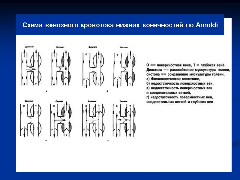 Схема венозного кровотока нижних конечностей по Arnoldi